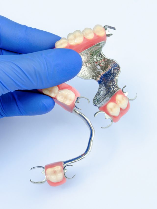 Benefits of partial dentures