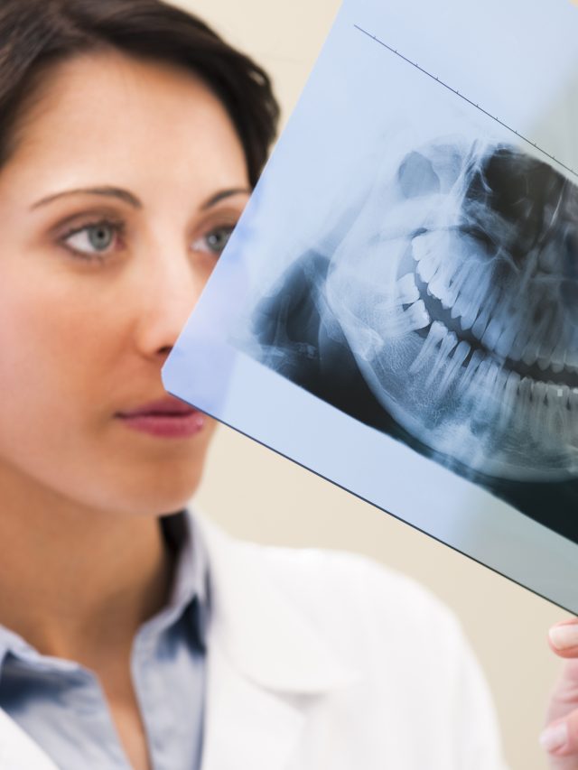 How often should you get dental X-rays?
